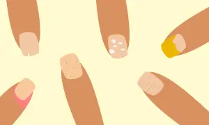 Illustration av fingrar med olika naglar. En nagel har vita prickar, en annan ser ut att ha en sjukdom.
