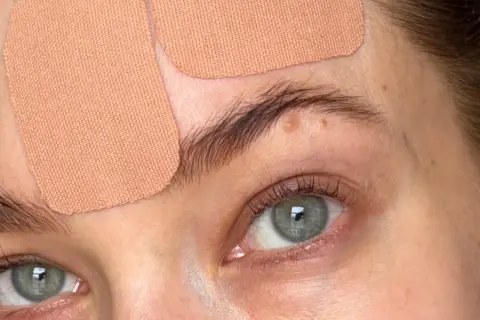 Närbild på ögon och panna med tejpremsor för face taping.