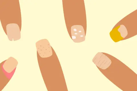 Illustration av fingrar med olika naglar. En nagel har vita prickar, en annan ser ut att ha en sjukdom.