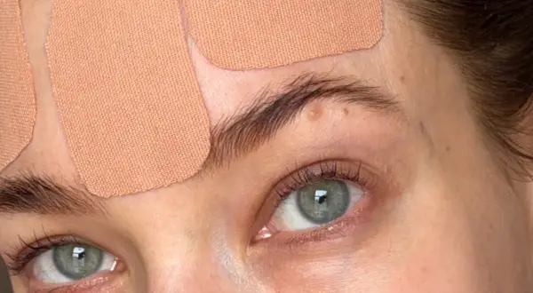 Närbild på ögon och panna med tejpremsor för face taping.