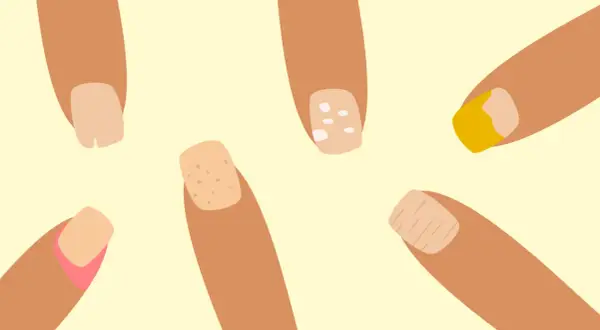 Illustration av fingrar med olika naglar. En nagel har vita prickar, en annan ser ut att ha en sjukdom.